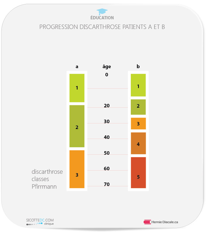 Discarthrose age physiologique versus discarthrose
