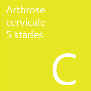 5 stades d'usure vertébrale cervicale (du cou).