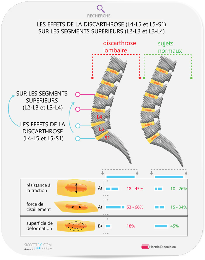 Les effets du discarthrose (disopathie) (L4-L5 et L5-S). Le soins naturel Cox pour maintenir la mobilitée.