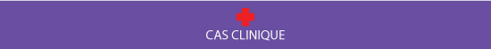 Cas clinique sténose spinale cervicale.