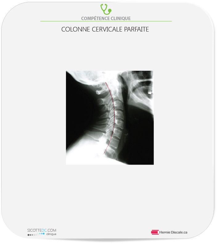 Courbe cervicale parfaite.