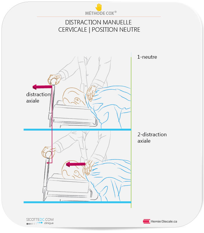 Les distraction manuelle pour arthrose cervicale, hernie discale et  douleur au bras.