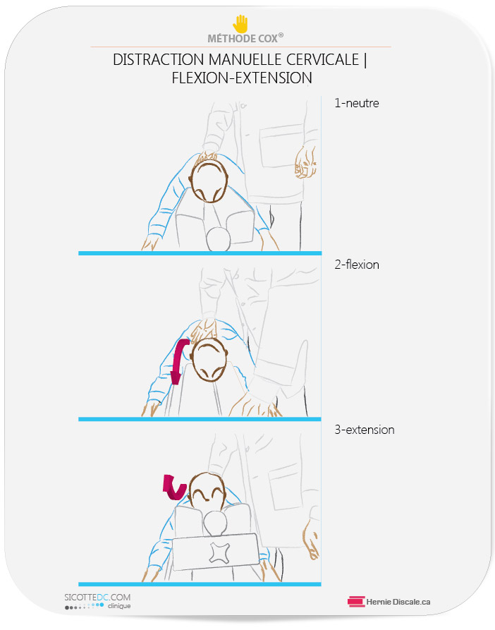 La méthode Cox pour les douleurs au cou. Ici la flexion-extension-rotation-flexion laterale manuelle.