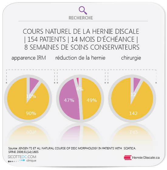 Cours naturel de la hernie discale. Resorption de la hernie discale - le cours naturel sans chirurgie.