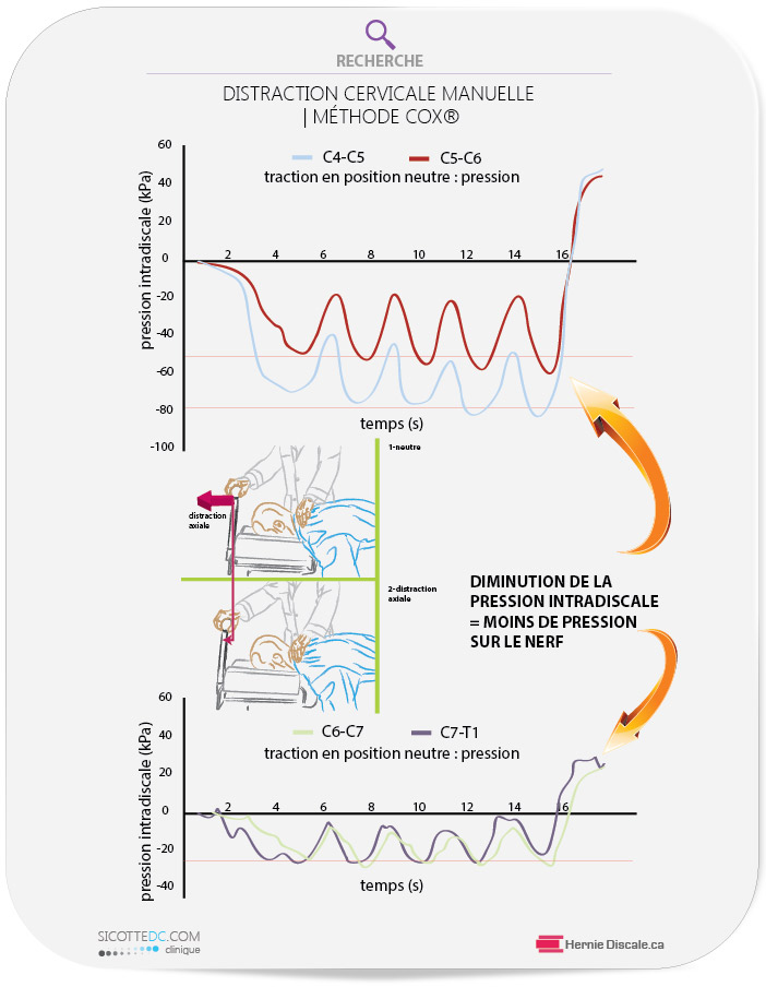 Diminution de la pression intradiscale cervicale. Alternative non chirurgicale pour les hernies discales.