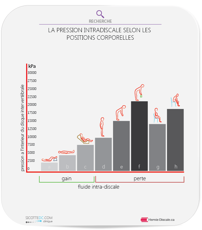 La pression intradiscale, position assis, coucher, debout, soulever des objets