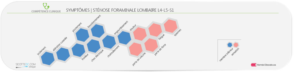 Les symptômes de la sténose foraminale lombaire L4-L5-S1
