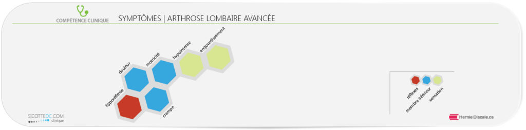 Les symptômes-arthrose-cervicale-avancée.
